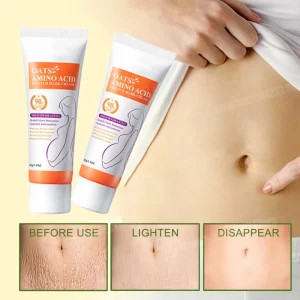 Stretch Marks Removal Cream Light